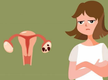 多囊卵巢综合征有哪些明显的症状？为什么多囊卵巢综合征会导致不易怀孕？多囊卵巢综合征患者进行试管婴儿技术？插图