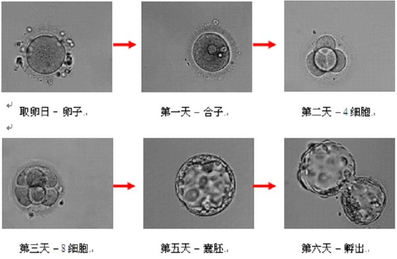 试管婴儿胚胎移植是怎么做的？具体操作会有哪些步骤？鲜胚、冻胚和囊胚是有区别？插图