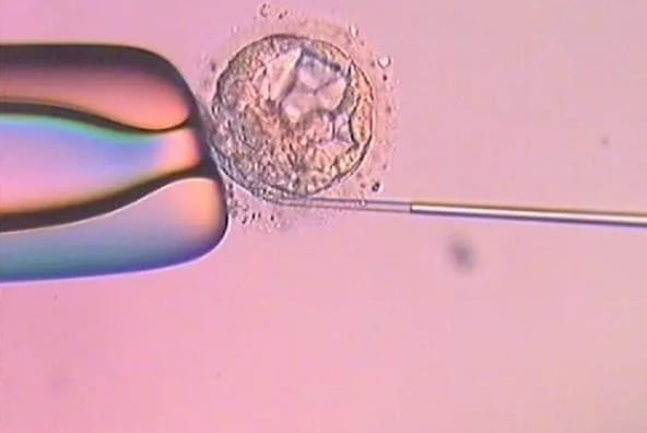 冷冻胚胎相比冷冻卵子哪个更好？选择冷冻胚胎的是哪些人？插图