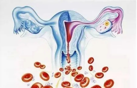 什么是子宫内膜过薄？导致子宫内膜薄的原因？子宫内膜薄可以做试管婴儿吗?插图(1)