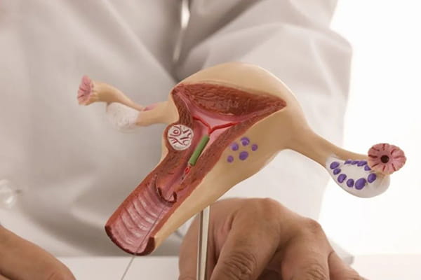 卵巢囊肿的女性可以做试管婴儿吗？揭秘试管婴儿的主要流程插图