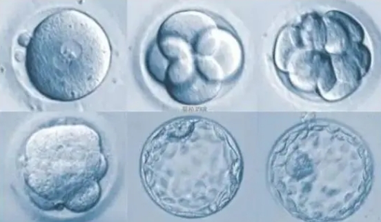 女性鲜胚移植需要满足哪些条件？试管婴儿鲜胚质量达到几级才能进行移植？插图