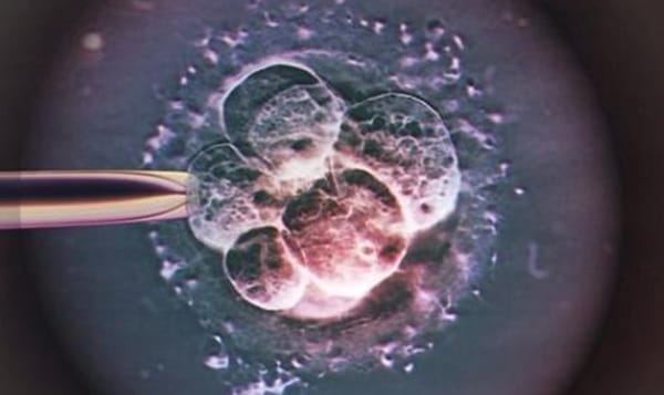 胚胎碎片率高是什么原因造成的？深度解析试管婴儿流程中的奥秘插图