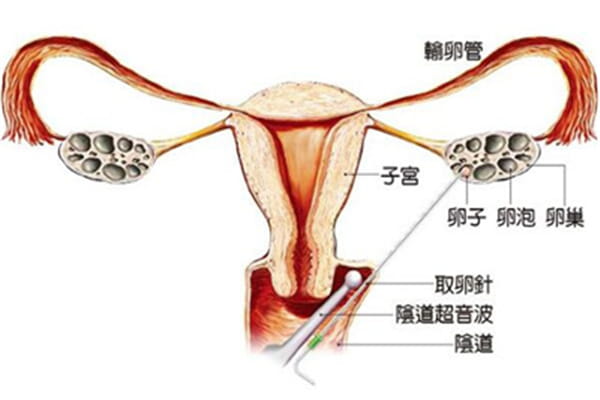 厦门大学附属成功医院试管流程是怎么样的？插图(1)